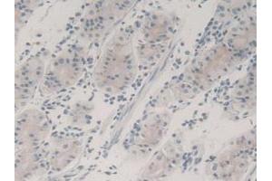 Detection of TGFb3 in Human Stomach Tissue using Monoclonal Antibody to Transforming Growth Factor Beta 3 (TGFb3) (TGFB3 抗体  (AA 24-300))