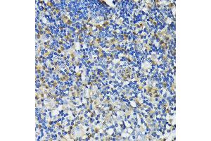 Immunohistochemistry of paraffin-embedded human appendix using CAMP antibody (ABIN7266146) at dilution of 1:200 (40x lens). (Cathelicidin 抗体  (AA 31-170))