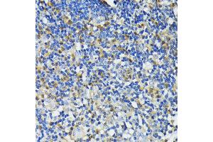 Immunohistochemistry of paraffin-embedded human appendix using CAMP antibody (ABIN7266146) at dilution of 1:200 (40x lens).