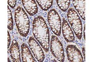 IHC analysis of Claudin 3/CLDN3 using anti-Claudin 3/CLDN3 antibody (ABIN7599625).