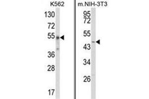 Western Blotting (WB) image for anti-WD Repeat, Sterile alpha Motif and U-Box Domain Containing 1 (WDSUB1) (Middle Region) antibody (ABIN453873)