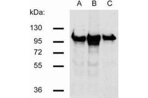 Western Blotting (WB) image for anti-Catenin (Cadherin-Associated Protein), beta 1, 88kDa (CTNNB1) antibody (ABIN614788) (CTNNB1 抗体)