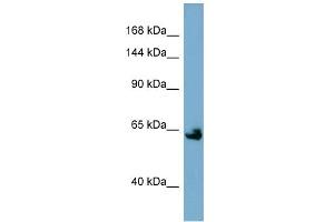 WB Suggested Anti-KL Antibody Titration:  0. (Klotho 抗体  (Middle Region))