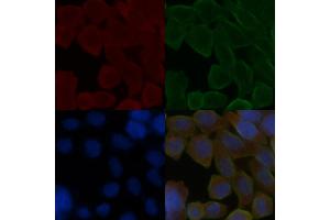 ABIN6258047 and ABIN6275822 staining Hela cells(30 min of UV treatment) by IF/ICC.