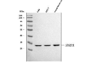 Western blot analysis of U1A/SNRPA using anti-U1A/SNRPA antibody (ABIN7600891). (SNRPA1 抗体  (AA 25-218))