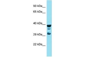 Host: Rabbit Target Name: RGS7BP Sample Type: MCF7 Whole Cell lysates Antibody Dilution: 1. (RGS7BP 抗体  (Middle Region))