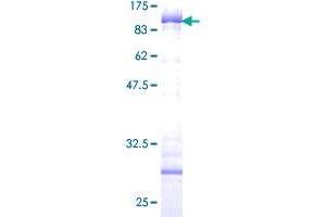 Cytokeratin 5 Protein (AA 1-590) (GST tag)