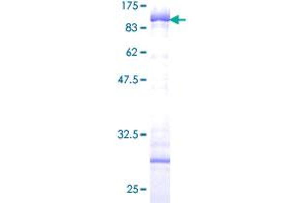 Cytokeratin 5 Protein (AA 1-590) (GST tag)