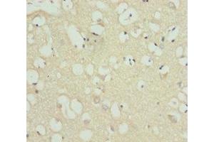 Immunohistochemistry of paraffin-embedded human brain tissue using ABIN7158523 at dilution of 1:100 (ACSL6 抗体  (AA 458-697))