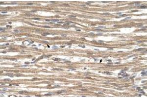 Immunohistochemical staining (Formalin-fixed paraffin-embedded sections) of human muscle with ACTR2 polyclonal antibody  at 4-8 ug/mL working concentration. (ACTR2 抗体  (N-Term))