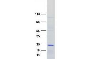 Validation with Western Blot