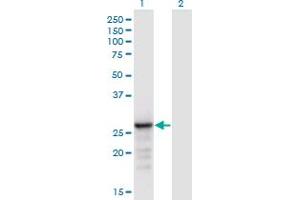 Western Blotting (WB) image for anti-Acidic (Leucine-Rich) Nuclear phosphoprotein 32 Family, Member B (ANP32B) (AA 1-251) antibody (ABIN948954)