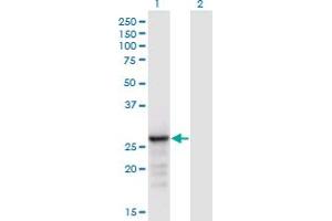 Western Blot analysis of ANP32B expression in transfected 293T cell line by ANP32B monoclonal antibody (M05), clone 8E10. (ANP32B 抗体  (AA 1-251))