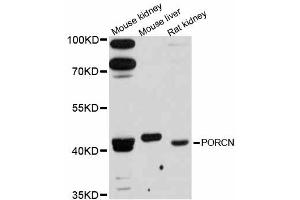 Western blot analysis of extracts of various cell lines, using PORCN antibody (ABIN6292717) at 1:3000 dilution. (PORCN 抗体)