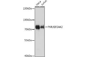 Western blot analysis of extracts of various cell lines, using PKR/PKR/EIF2 antibody (ABIN1679688 and ABIN3018462) at 1:1000 dilution. (EIF2AK2 抗体)