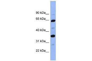 SERPINC1 antibody used at 1 ug/ml to detect target protein. (SERPINC1 抗体)