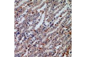 Immunohistochemical analysis of Caldesmon staining in human kidney formalin fixed paraffin embedded tissue section.
