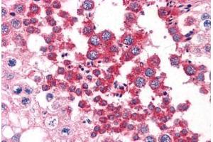 Human Testis: Formalin-Fixed, Paraffin-Embedded (FFPE) (SH3GLB1 抗体  (AA 1-366))