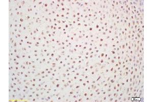 Formalin-fixed and paraffin embedded mouse embryo labeled with Rabbit Anti ZNF268 Polyclonal Antibody, Unconjugated  at 1:200 followed by conjugation to the secondary antibody and DAB staining (ZNF268 抗体  (AA 286-358))