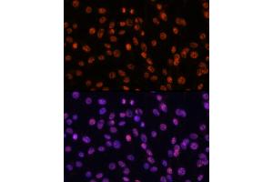 Immunofluorescence analysis of C6 using SF3B1 antibody (ABIN7270543) at dilution of d100 (40x lens).