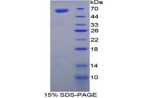 SDS-PAGE analysis of Mouse TGM1 Protein. (TGM1 蛋白)