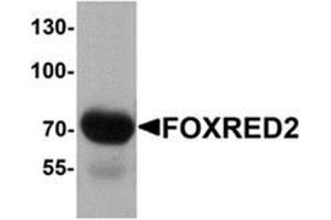 Western blot analysis of FOXRED2 in human lung tissue lysate with FOXRED2 antibody at 1 μg/mL. (FOXRED2 抗体  (N-Term))