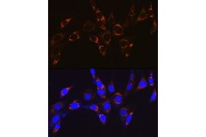 Immunohistochemistry (IHC) image for anti-ATP Synthase, H+ Transporting, Mitochondrial F1 Complex, beta Polypeptide (ATP5B) antibody (ABIN7265722)