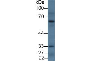 Detection of DRD2 in Rat Cerebrum lysate using Polyclonal Antibody to Dopamine Receptor D2 (DRD2) (Dopamine d2 Receptor 抗体  (AA 194-421))
