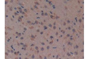 Detection of CFH in Mouse Brain Tissue using Polyclonal Antibody to Complement Factor H (CFH) (Complement Factor H 抗体  (AA 915-1156))