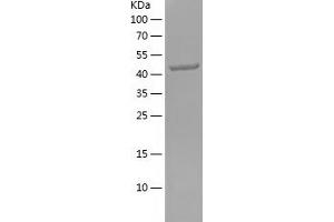 Western Blotting (WB) image for Fibronectin (AA 1008-1231) protein (His-IF2DI Tag) (ABIN7122958) (Fibronectin Protein (AA 1008-1231) (His-IF2DI Tag))