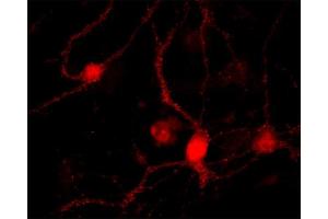 Immunocytochemistry (ICC) image for anti-RAB26, Member RAS Oncogene Family (RAB26) antibody (ABIN1742529) (RAB26 抗体)