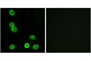 Immunofluorescence analysis of MCF7 cells, using GPR63 Antibody. (GPR63 抗体  (AA 370-419))