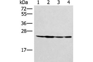 Western blot analysis of Hela 231 and A549 cell Mouse liver tissue lysates using SSSCA1 Polyclonal Antibody at dilution of 1:400 (SSSCA1 抗体)