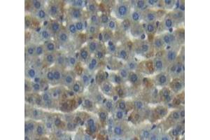 IHC-P analysis of Kidney tissue, with DAB staining. (MMP20 抗体  (AA 137-398))