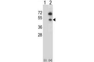 Western blot analysis of GNAS (arrow) using GNAS Antibody (C-term) Cat. (GNAS 抗体  (C-Term))