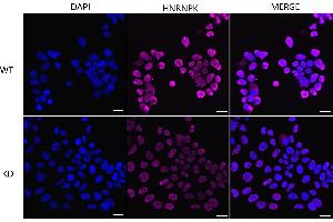anti-Heterogeneous Nuclear Ribonucleoprotein K (HNRNPK) antibody