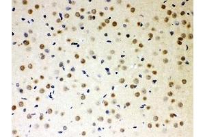 IHC-P: PKC iota antibody testing of rat brain tissue (PKC iota 抗体  (AA 21-214))