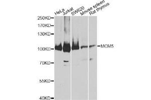 Western blot analysis of extracts of various cell lines, using MCM5 antibody. (MCM5 抗体  (AA 1-230))