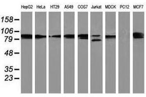 Image no. 2 for anti-Protein Kinase C, epsilon (PRKCE) antibody (ABIN1500232) (PKC epsilon 抗体)