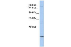 UBR2 antibody used at 1 ug/ml to detect target protein. (UBR2 抗体  (C-Term))