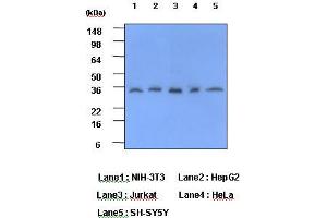Western Blotting (WB) image for anti-C-Reactive Protein (CRP) (AA 19-224) antibody (ABIN317506) (CRP 抗体  (AA 19-224))