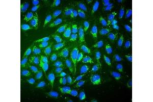 IF analysis of ALDH2 using anti-ALDH2 antibody (ABIN7603122). (ALDH2 抗体  (N-Term))