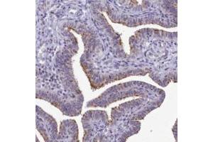 Immunohistochemical staining of human fallopian tube with B9D2 polyclonal antibody  shows distinct positivity in ciliated cells. (B9D2 抗体)