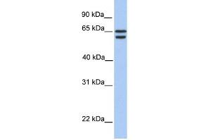 WB Suggested Anti-CDYL2 Antibody Titration:  0. (CDYL2 抗体  (N-Term))