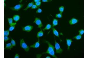 IF analysis of LARP1 using anti-LARP1 antibody (ABIN7599861).