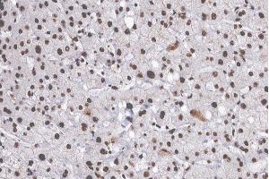 ABIN6269028 at 1/200 staining human Liver tissue sections by IHC-P. (CDKN2B 抗体  (Internal Region))