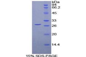 SDS-PAGE analysis of Human LILRA2 Protein. (LILRA2 蛋白)