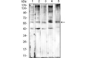 Western Blotting (WB) image for anti-Keratin 6A (KRT6A) (AA 253-352) antibody (ABIN7193708)