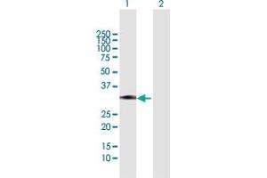 Western Blot analysis of ZCRB1 expression in transfected 293T cell line by ZCRB1 MaxPab polyclonal antibody. (ZCRB1 抗体  (AA 1-217))