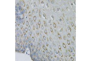 Immunohistochemistry of paraffin-embedded human esophagus using EIF4B Antibody. (EIF4B 抗体)